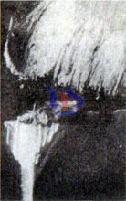 cemented carbide tool wear cemented carbide tool wear