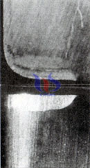 cemented carbide tool wear cemented carbide tool wear